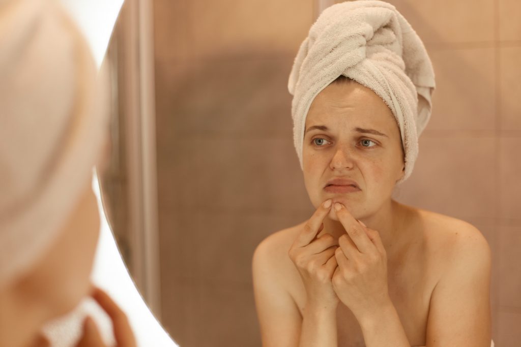top 10 home remedies for pimples on face