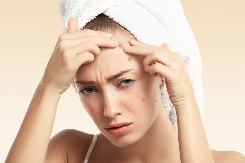 cystic acne on forehead