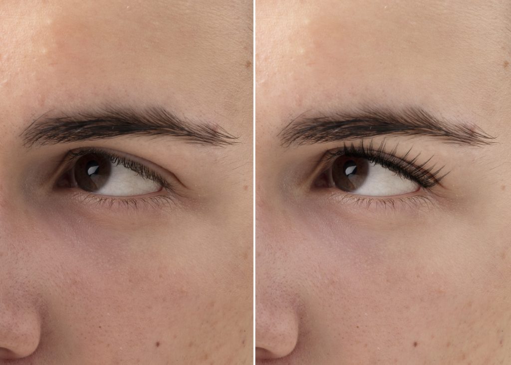 turmeric dark spot corrector serum before and after
