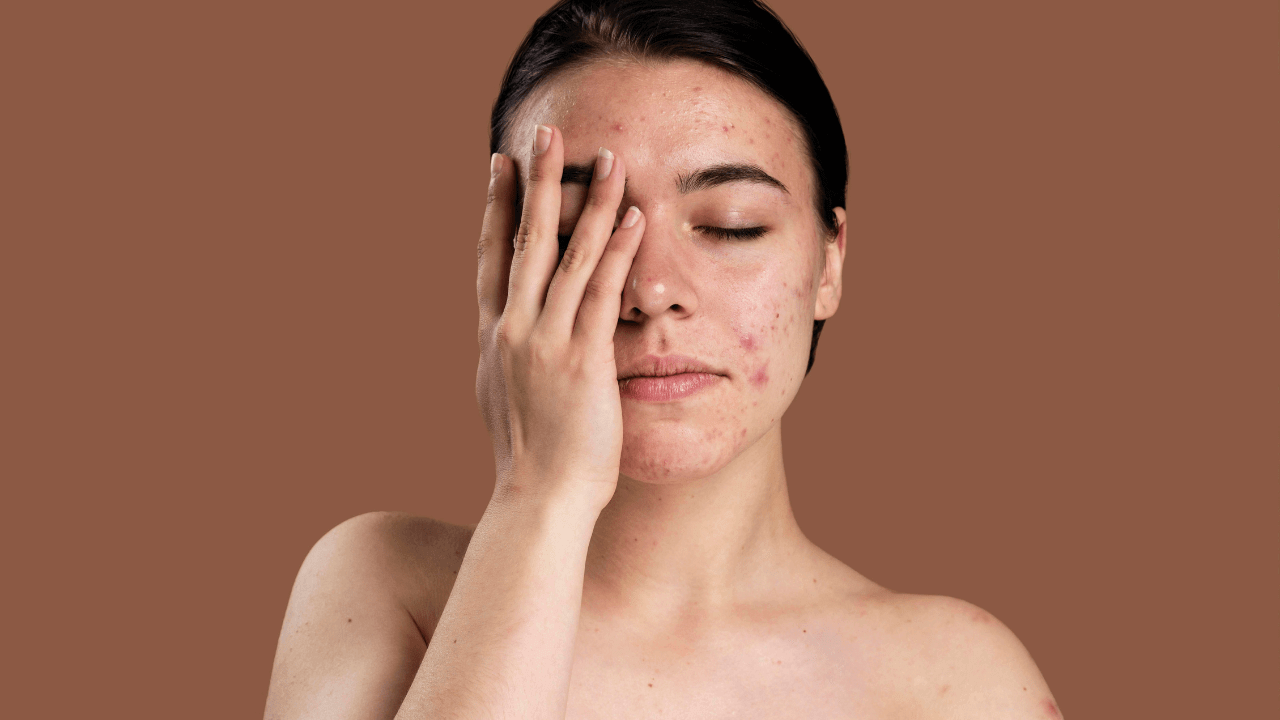 remove dark spots on face